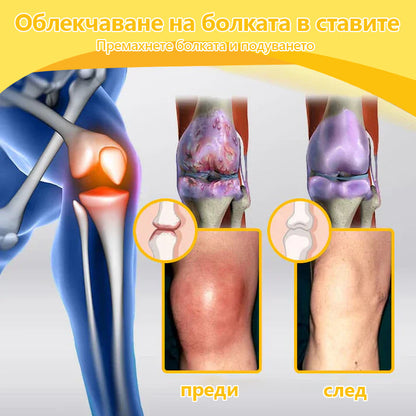 🍀🍀ArthroFree™ Облекчаващ болката крем за кости с пчелна отрова🐝(Специално за по-възрастни и AAOS препоръчва) x