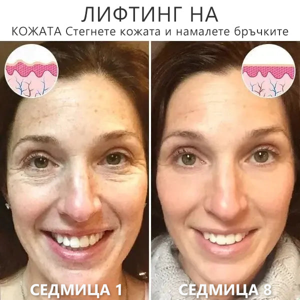 🎉🎉 Промоция за последния ден 70%off Fubsta™ Подмладяващ серум SkinFirming