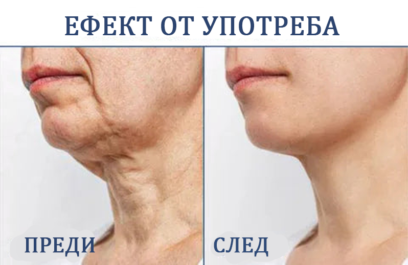 🔥👩‍⚕️𝐋𝐚𝐬𝐭 𝐃𝐚𝐲 𝐃𝐢𝐬𝐜𝐨𝐮𝐧𝐭: 𝟕5% 𝐎𝐅𝐅🌐𝐅𝐮𝐛𝐬𝐭 𝐚® Advanced SkinTightening Подмладяващ крем: Възстановете еластичността на кожата💦