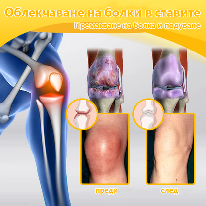 💟💨Spzv™ Крем за терапия на стави и кости с пчелна отрова 🐝 (Екстракт от новозеландски пчели, специализиран за ортопедични заболявания и болки при артрит)