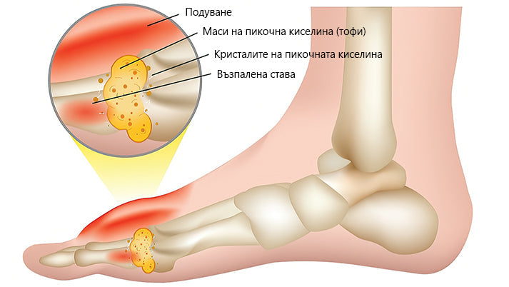 🍀🍀ArthroFree™ Облекчаващ болката крем за кости с пчелна отрова🐝(Специално за по-възрастни и AAOS препоръчва) x