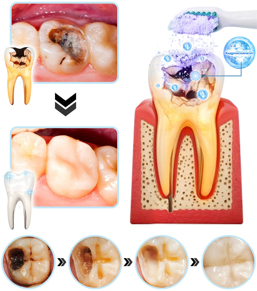 LEFUN™ Възстановяващ стоматологичен минерален прах (препоръчва се от STF) x