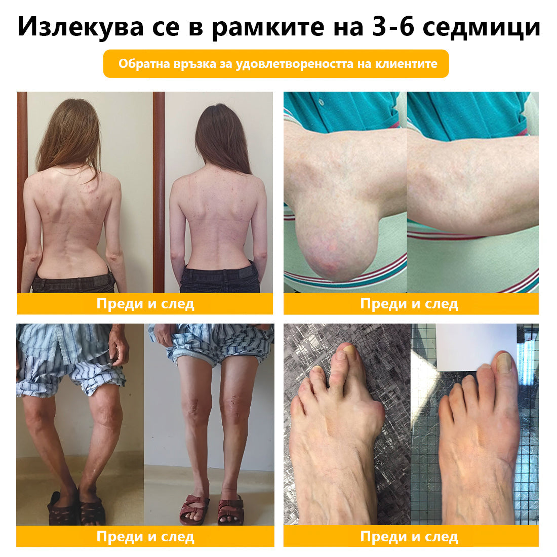 🍀🍀ArthroFree™ Облекчаващ болката крем за кости с пчелна отрова🐝(Специално за по-възрастни и AAOS препоръчва) x