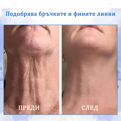 🔥👩‍⚕️𝐋𝐚𝐬𝐭 𝐃𝐚𝐲 𝐃𝐢𝐬𝐜𝐨𝐮𝐧𝐭: 𝟕5% 𝐎𝐅𝐅🌐𝐅𝐮𝐛𝐬𝐭 𝐚® Advanced SkinTightening Подмладяващ крем: Възстановете еластичността на кожата💦