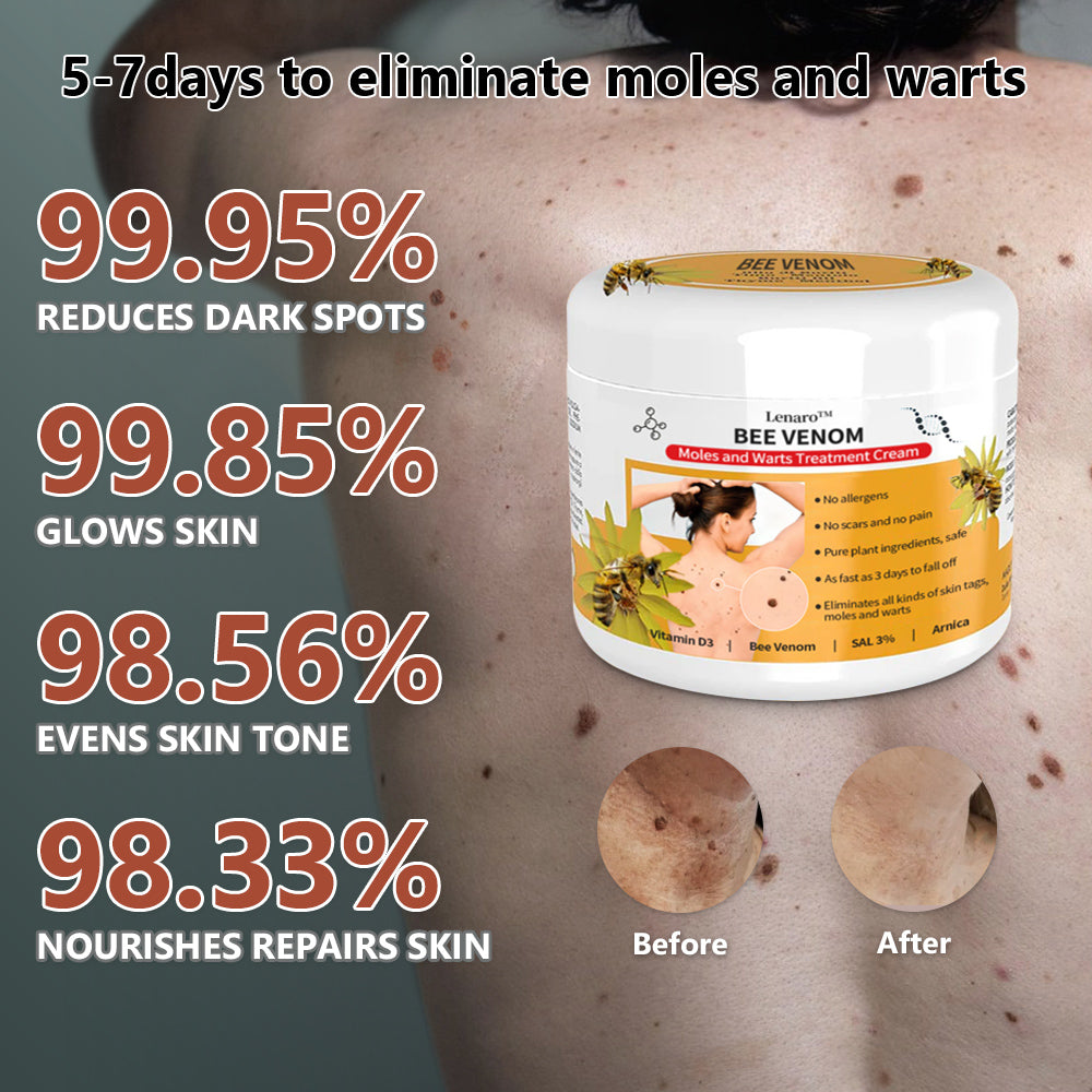 [✨Last day for 50% off✨]🐝🐝🐝 Lenaro™ Bee Venom Mole and Wart Treatment Cream(👨‍⚕AAD RECOMMENDS)