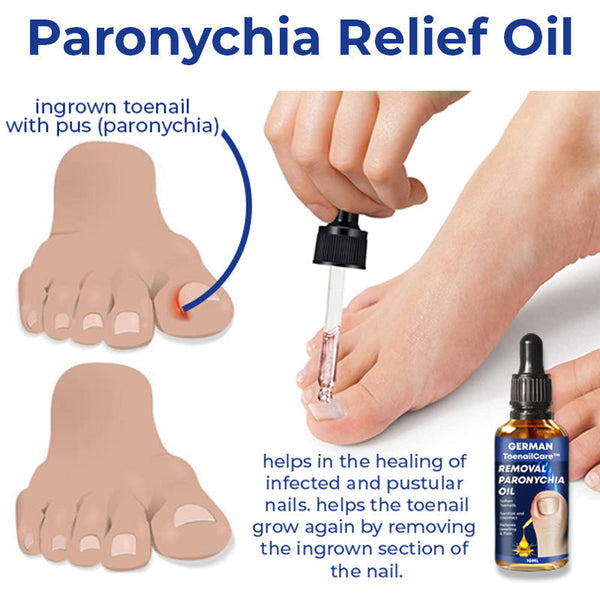 🔥German ToenailCare™ Removal Paronychia Oil 🔥(Limited time discount Last 30 minutes)