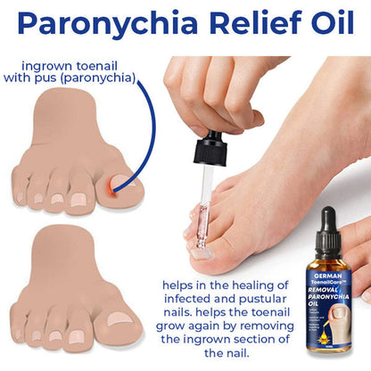 🔥German ToenailCare™ Removal Paronychia Oil 🔥(Limited time discount Last 30 minutes)