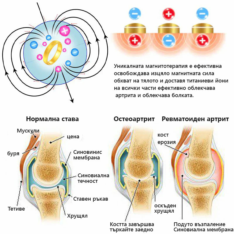 Пръстен за котешко око с лимфна магнитна терапия CZTICLE™ Оферта за ограничено време👑👑