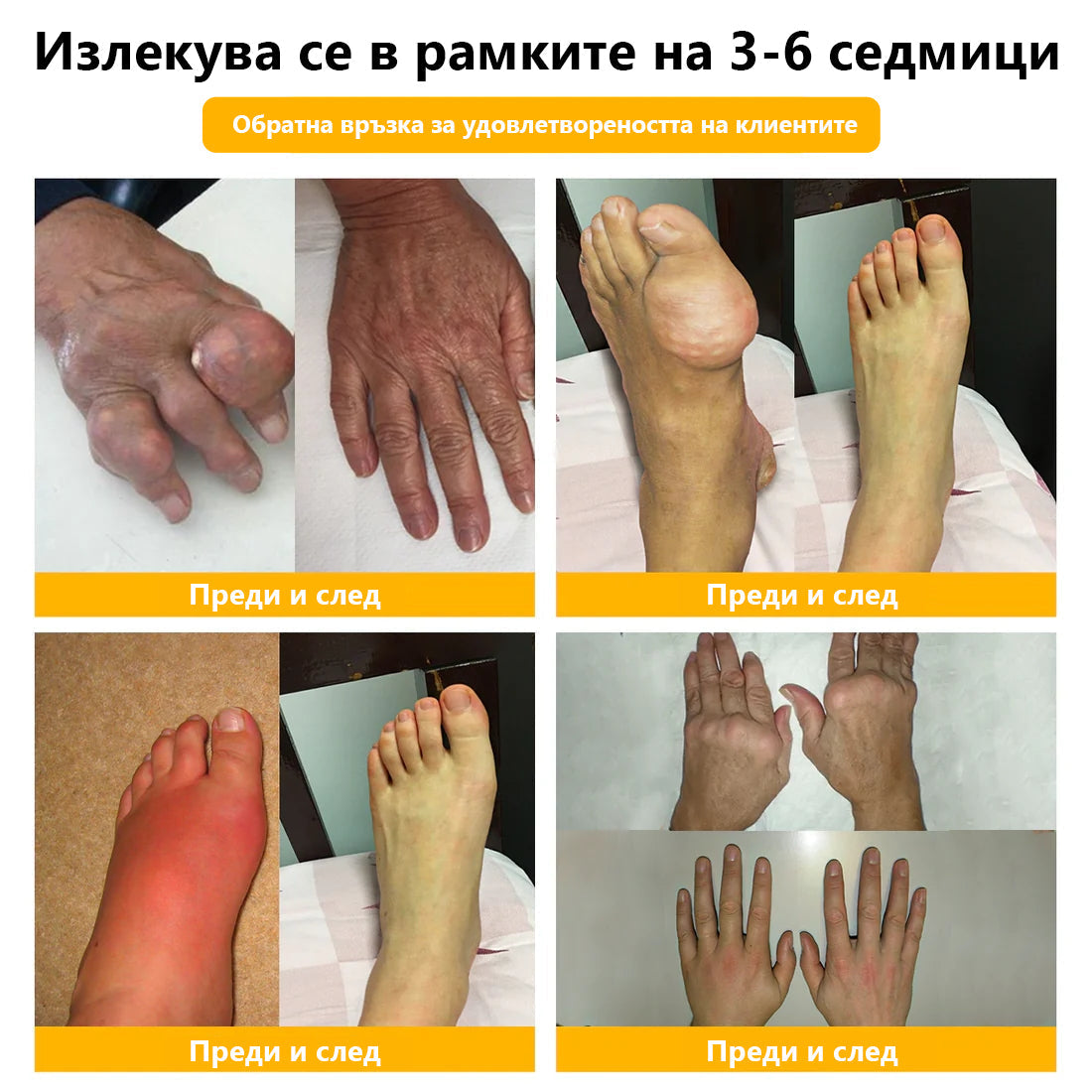 🍀🍀ArthroFree™ Облекчаващ болката крем за кости с пчелна отрова🐝(Специално за по-възрастни и AAOS препоръчва) x