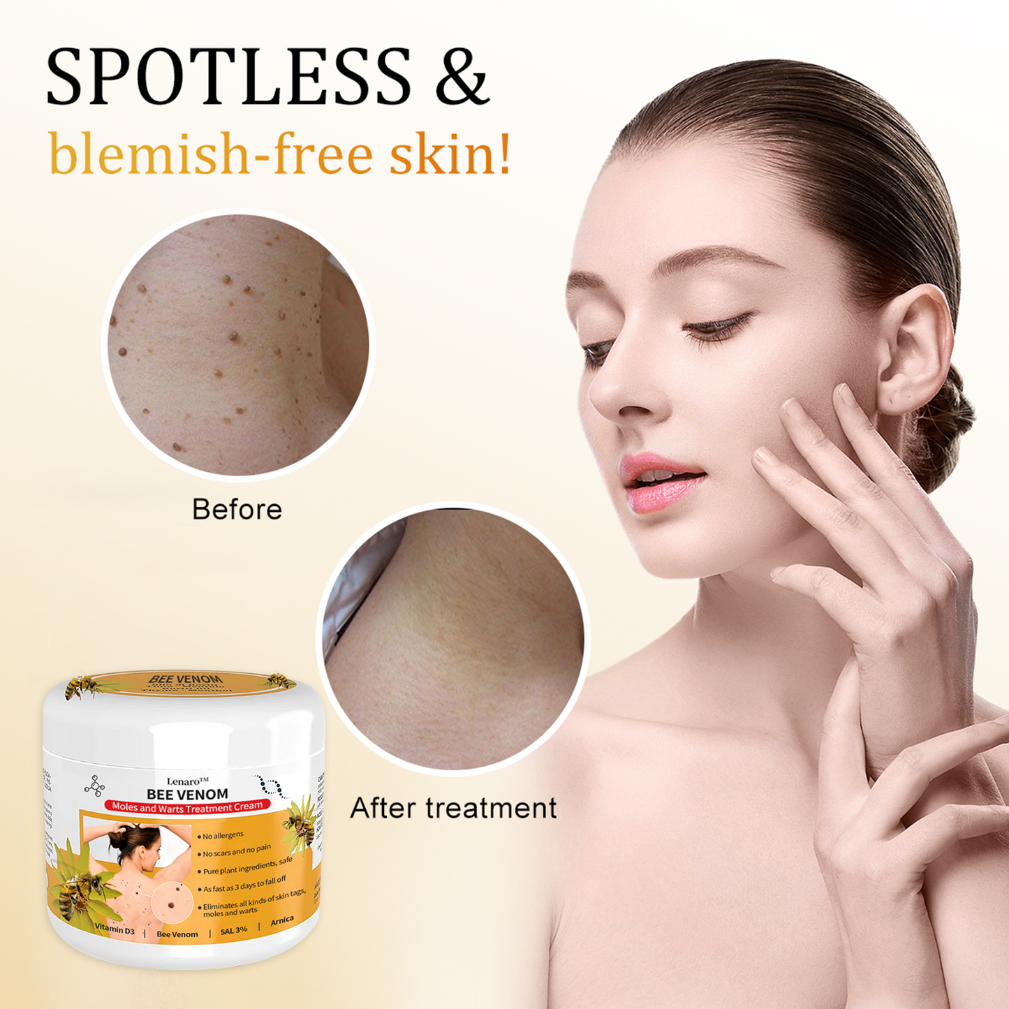 [✨Last day for 50% off✨]🐝🐝🐝 Lenaro™ Bee Venom Mole and Wart Treatment Cream(👨‍⚕AAD RECOMMENDS)