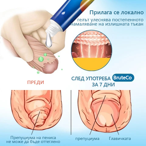 BruteCo™ гел за корекция на нежелана кожа (🔥 Последен ден на промоцията, 80% отстъпка🔥)