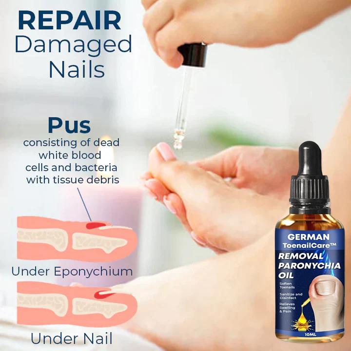 🔥German ToenailCare™ Removal Paronychia Oil 🔥(Limited time discount Last 30 minutes)