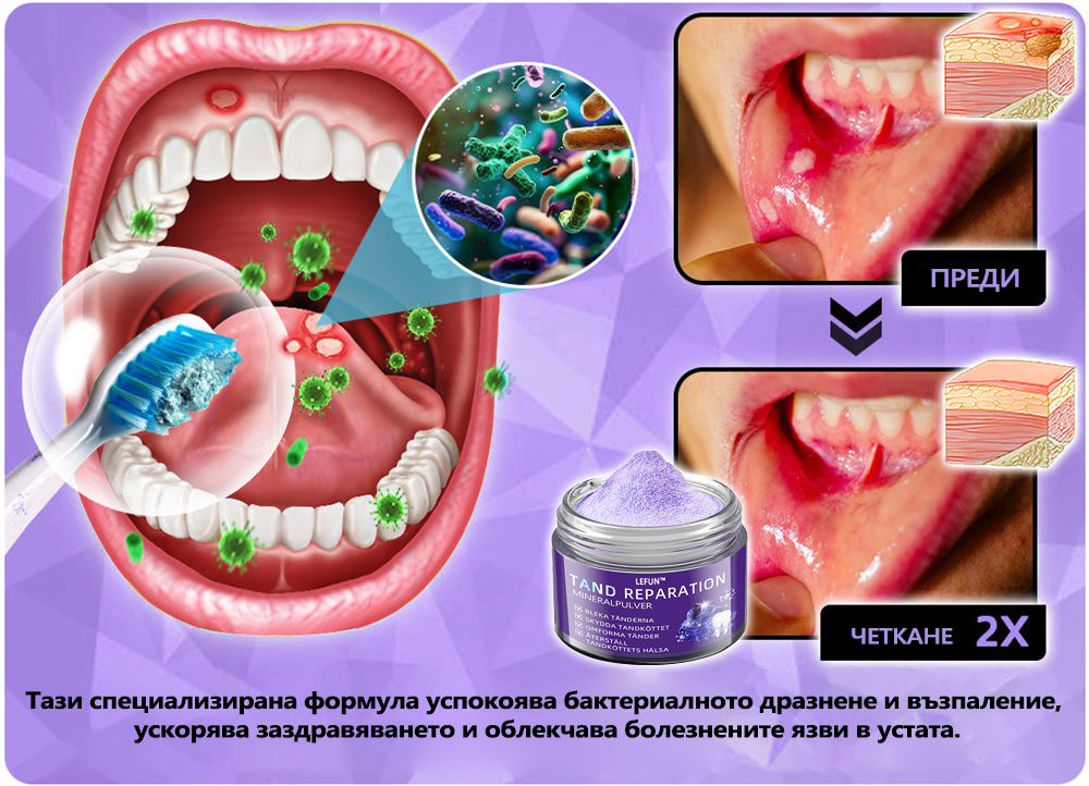 LEFUN™ Възстановяващ стоматологичен минерален прах (препоръчва се от STF) x