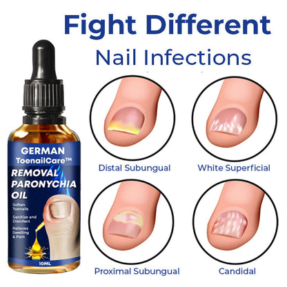 🔥German ToenailCare™ Removal Paronychia Oil 🔥(Limited time discount Last 30 minutes)