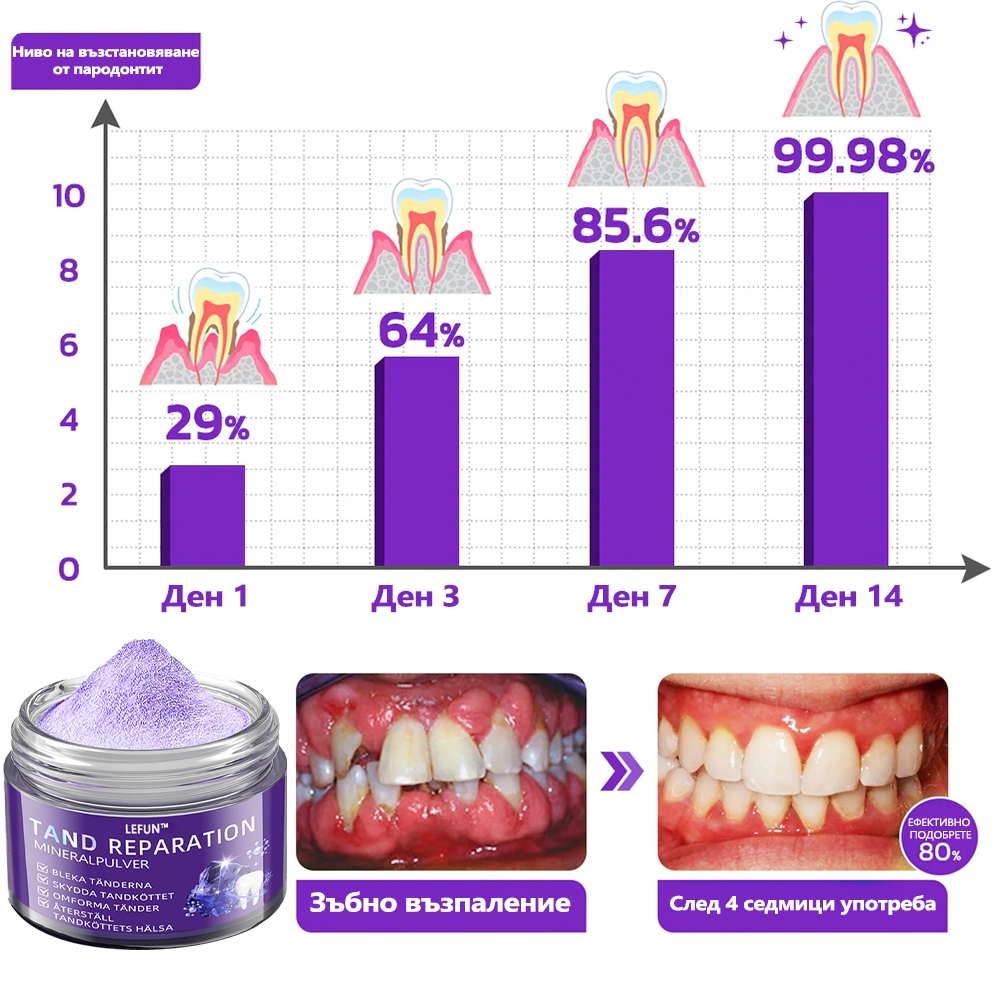 LEFUN™ Възстановяващ стоматологичен минерален прах (препоръчва се от STF) x