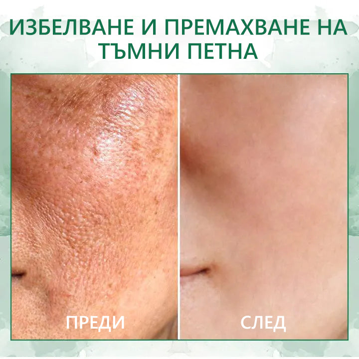 🎉🎉 Промоция за последния ден 70%off Fubsta™ Подмладяващ серум SkinFirming