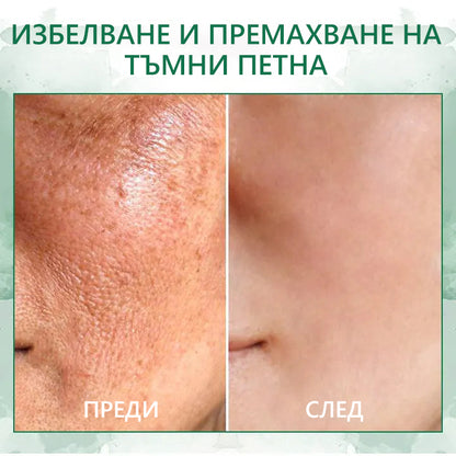 🎉🎉 Промоция за последния ден 70%off Fubsta™ Подмладяващ серум SkinFirming