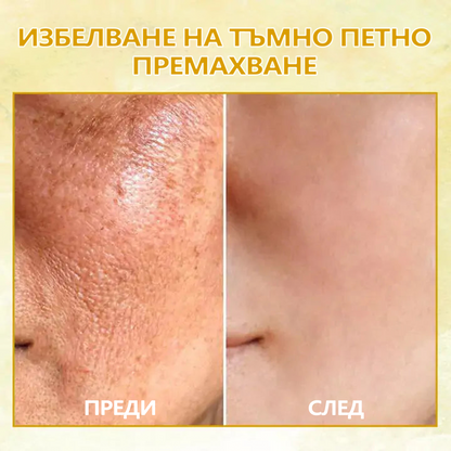 🔥🔥Последен ден отстъпка: 70% OFF Fubsta® SkinFirming Rejuvenating Oil