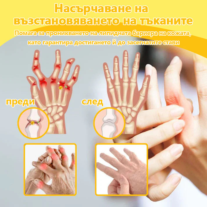 🍀🍀ArthroFree™ Облекчаващ болката крем за кости с пчелна отрова🐝(Специално за по-възрастни и AAOS препоръчва) x