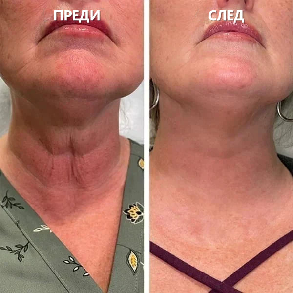 🎉🎉 Промоция за последния ден 70%off Fubsta™ Подмладяващ серум SkinFirming